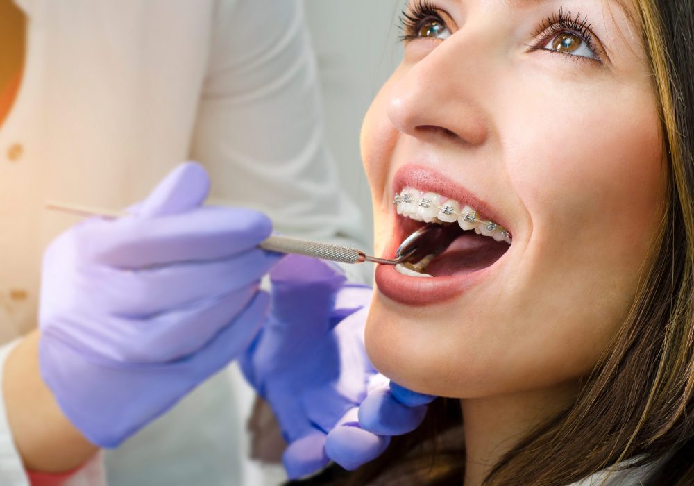 Closeup of beautiful girl on dental braces check up